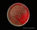 virulent strain of Streptococcus pneumoniae (pneumococcus), mucoid